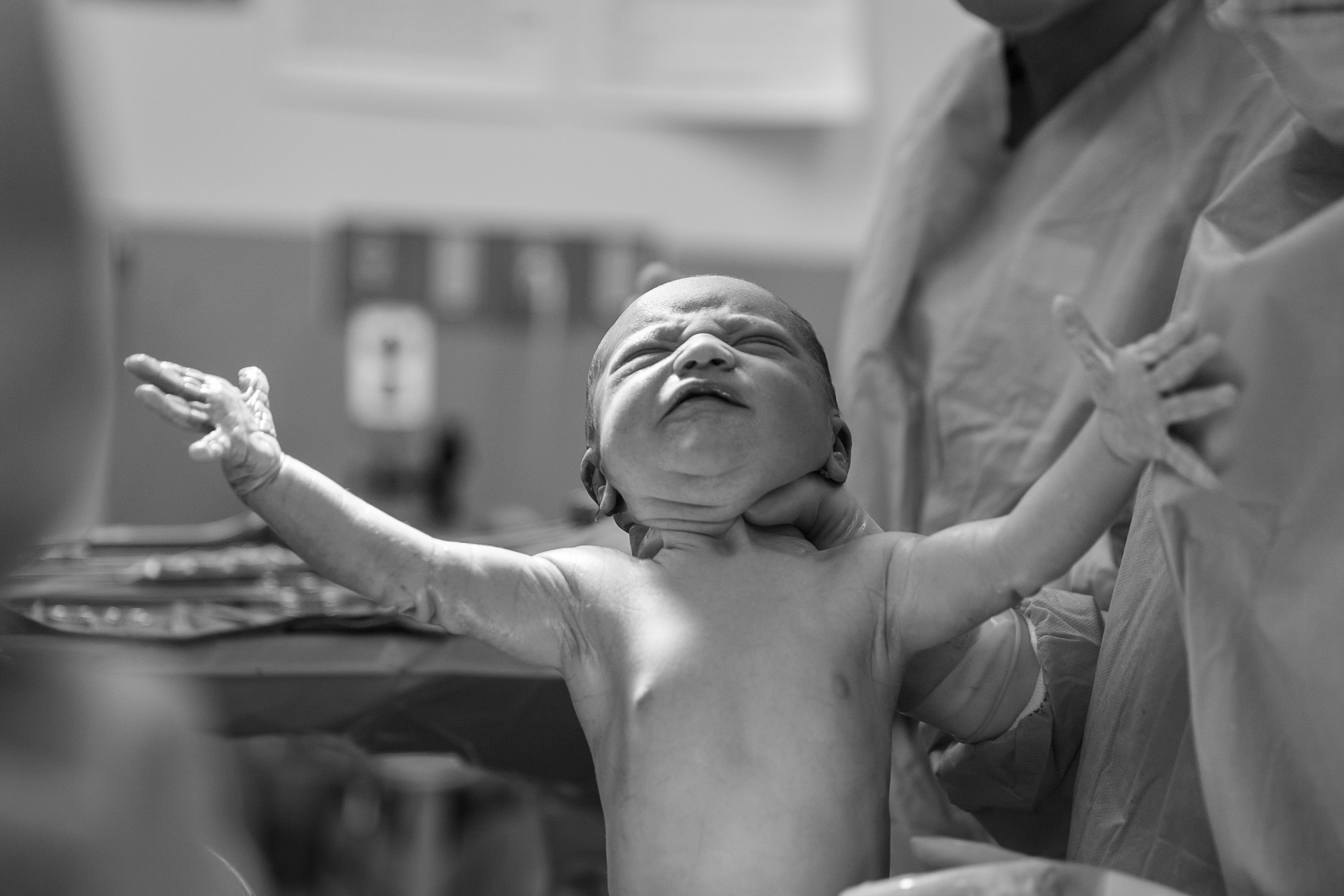 Caesarean Delivery Unveiled – The Pros, The Cons, and The Aftercare
